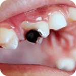 condition-image